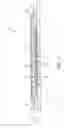 Fig. 02 - Fiber support arrangement for a downhole tool and method