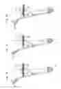 Fig. 06 - Traveling apparatus
