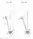 Fig. 14 - Traveling apparatus