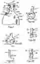 Fig. 04 - Apparatus and methods for carrying a bottle
