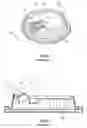 Fig. 04 - Beverage cup lid with a pull back type sipping hole closure