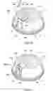 Fig. 07 - Beverage cup lid with a pull back type sipping hole closure