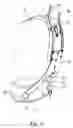 Fig. 07 - BACKPACK SUSPENSION SYSTEM