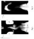 Fig. 03 - System and method for patient balance and position analysis