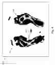 Fig. 04 - System and method for patient balance and position analysis