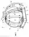 Fig. 04 - Shielded Device Containment Vessel