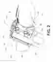 Fig. 03 - Gauge mount for motorcycle