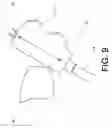 Fig. 10 - Gauge mount for motorcycle