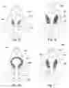 Fig. 10 - Retention system