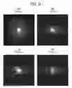 Fig. 07 - MRI apparatus and control method of steady-state free precession (SSFP) with phase cycling, combining low and high frequency images multiplied by a scaling factor
