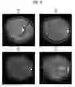 Fig. 09 - MRI apparatus and control method of steady-state free precession (SSFP) with phase cycling, combining low and high frequency images multiplied by a scaling factor