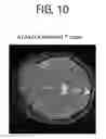 Fig. 11 - MRI apparatus and control method of steady-state free precession (SSFP) with phase cycling, combining low and high frequency images multiplied by a scaling factor