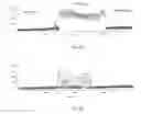 Fig. 03 - RF enabled surgical cart and use of same in operating room environment
