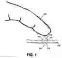Fig. 02 - Tactile feedback for capacitive sensors
