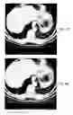Fig. 06 - Imaging volume data