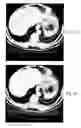 Fig. 07 - Imaging volume data