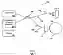 Fig. 02 - Optical coherence tomography for eye-length measurement
