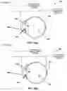 Fig. 04 - Optical coherence tomography for eye-length measurement