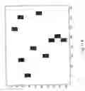 Fig. 17 - Method and a system for determination of particles in a liquid sample