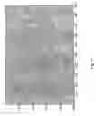 Fig. 18 - Method and a system for determination of particles in a liquid sample