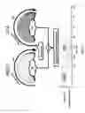 Fig. 03 - Measuring blood volume with C-arm computed tomography