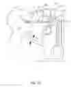 Fig. 05 - Orthovoltage radiosurgery