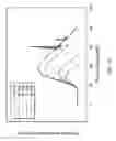 Fig. 07 - Orthovoltage radiosurgery