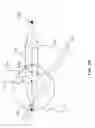 Fig. 18 - Orthovoltage radiosurgery