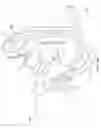 Fig. 40 - Orthovoltage radiosurgery