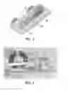 Fig. 03 - Micro-Electro-Mechanical System (Mems) Capacitor Microphone and Method of Manufacturing Thereof