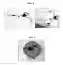 Fig. 09 - Hearing aid using printed circuit board
