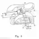 Fig. 06 - Earplug Earphone