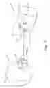 Fig. 08 - Earplug Earphone