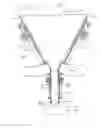 Fig. 24 - Electromagnetic lever diaphragm audio transducer
