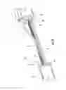 Fig. 06 - Cable assembly with access point