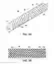 Fig. 06 - Belt support roller design