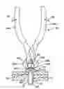Fig. 01 - Release pin