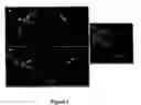 Fig. 02 - Blood Clot-Targeted Nanoparticles