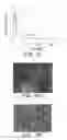 Fig. 15 - Albumin-based colloid composition having at least one protected thiol region, methods of making, and methods of use