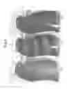 Fig. 04 - Opaque multi-phase dentifrice with alternating bands