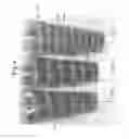Fig. 05 - Opaque multi-phase dentifrice with alternating bands