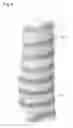 Fig. 07 - Opaque multi-phase dentifrice with alternating bands