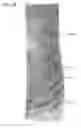 Fig. 14 - Opaque multi-phase dentifrice with alternating bands