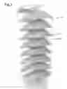 Fig. 08 - Transparent multi-phase dentifrice with coils