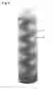 Fig. 09 - Transparent multi-phase dentifrice with coils