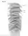 Fig. 13 - Transparent multi-phase dentifrice with coils