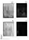 Fig. 03 - Skin equivalents derived from umbilical cord mesenchymal stem/progenitor cells and umbilical cord epithelial stem/progenitor cells