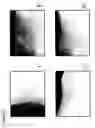 Fig. 04 - Skin equivalents derived from umbilical cord mesenchymal stem/progenitor cells and umbilical cord epithelial stem/progenitor cells