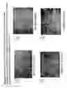 Fig. 06 - Skin equivalents derived from umbilical cord mesenchymal stem/progenitor cells and umbilical cord epithelial stem/progenitor cells
