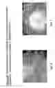 Fig. 08 - Skin equivalents derived from umbilical cord mesenchymal stem/progenitor cells and umbilical cord epithelial stem/progenitor cells